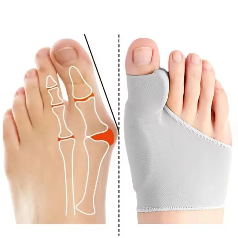 Toe Separator Bunion Corrector